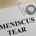 How To Care For Your Knee Following Meniscus Tear Injury