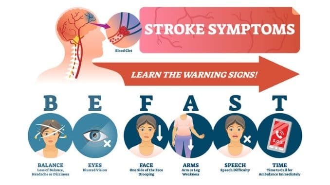 stroke-symptoms-illustration-signs