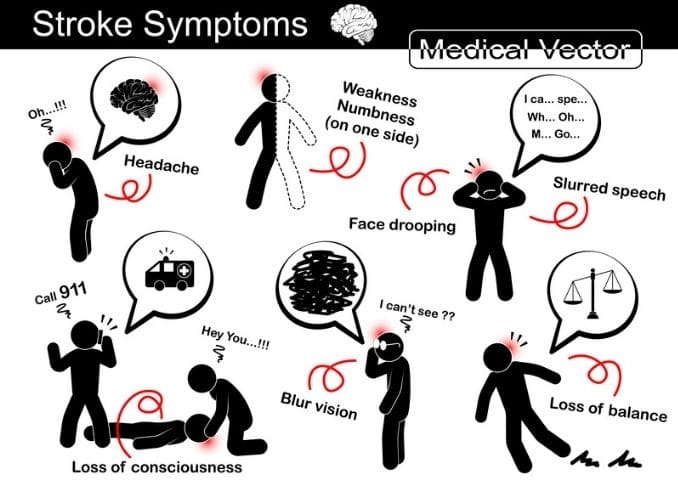 stroke-symptoms-illustration