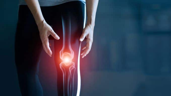 5 Easy Exercises for People with Osteoarthritis