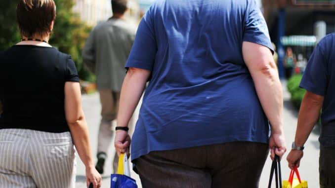 Obesity-overweight people