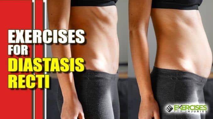 Exercises for Diastasis Recti EFI Youtube Videos