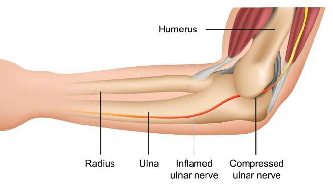 Exercises for Cubital Tunnel Syndrome Anatomy