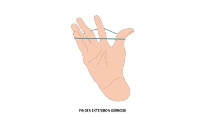 Finger Extension Exercise Exercises For Injuries Finger Extension Exercise Exercises For Injuries