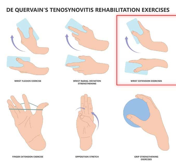 Wrist Extension- De Quervain's tenosynovitis