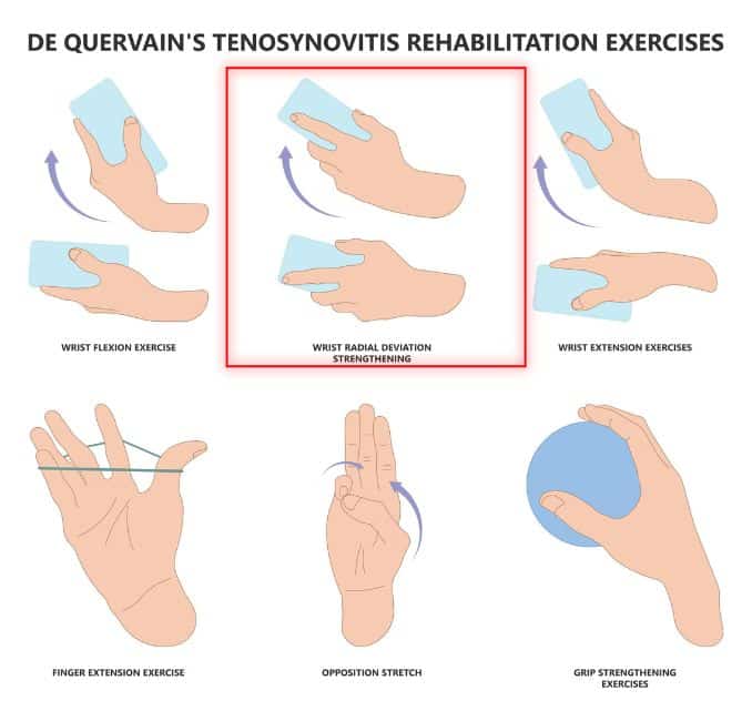  Wrist Radial Reviation Strengthening- De Quervain's tenosynovitis
