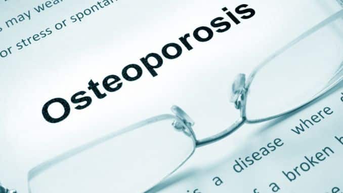 Osteoporosis - The Silent Disease