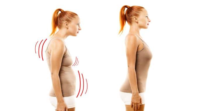 Forward Head Posture - Posture Correction Exercises