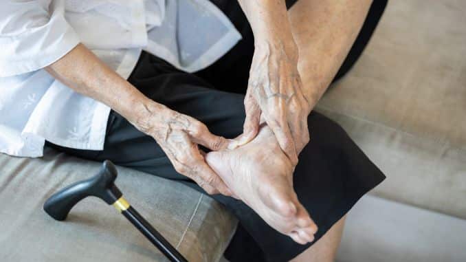 Rediscovering ankle osteoarthritis