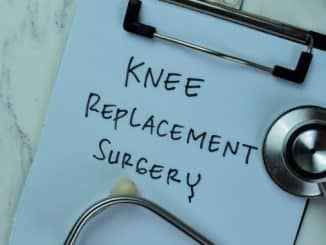 The Importance of Exercise after Knee Replacement Surgery Thumbnail