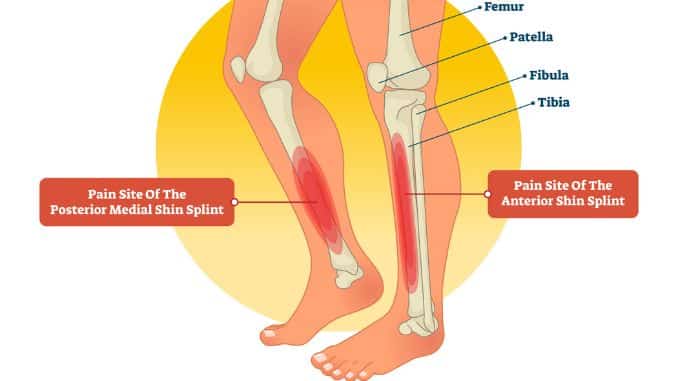 Anatomy of Shin-Shin Splints Exercises