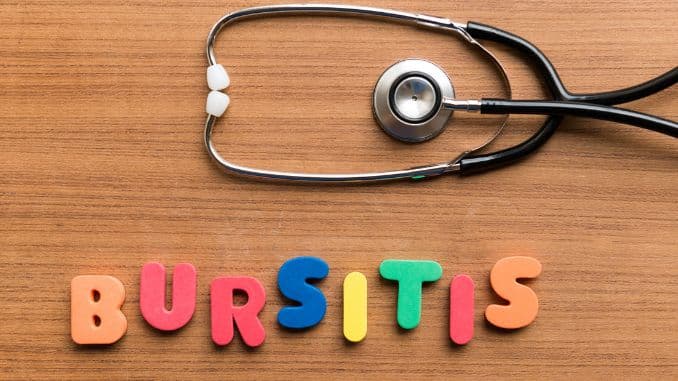 bursitis sites - Best Elbow Pad for Bursitis
