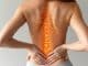 Spondylolisthesis Exercises: Taking Charge of Your Back Health