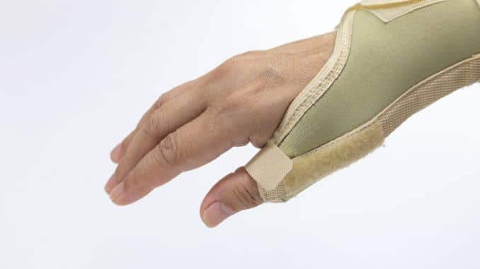 Surgical Treatment for De Quervain’s Tenosynovitis
